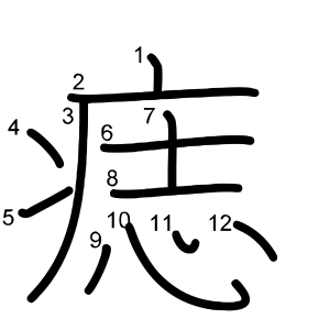 痣